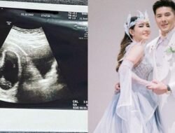 Kabar Bahagia Via Vallen: Menanti Kehadiran Adik Agham